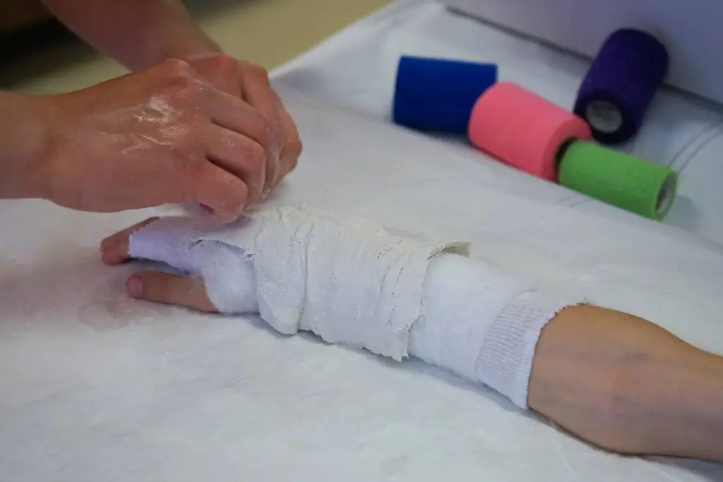 I recently broke my hand