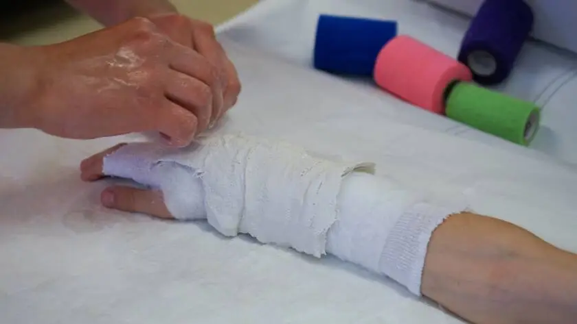 I recently broke my hand